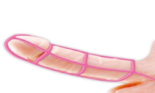 Bao Cao Su Đôn Dên lưới